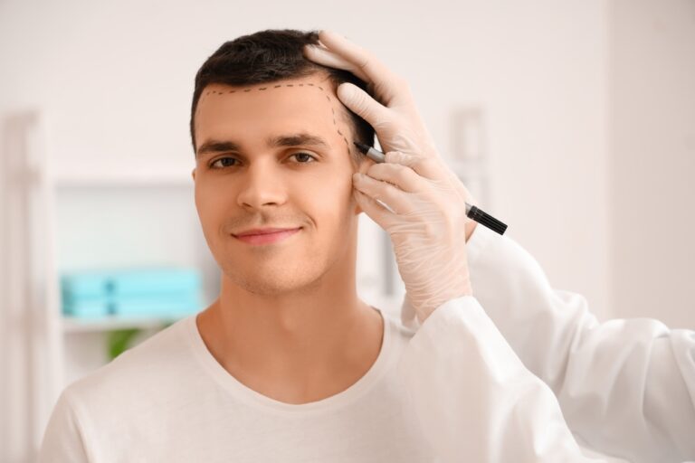 Hair Transplant in Turkey